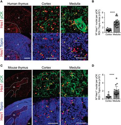 Abrogation of Notch Signaling in Embryonic TECs Impacts Postnatal mTEC Homeostasis and Thymic Involution